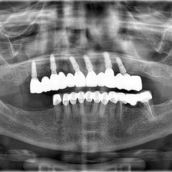 Surgery & <br>Implantology